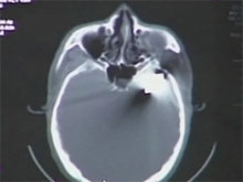 Фото новости